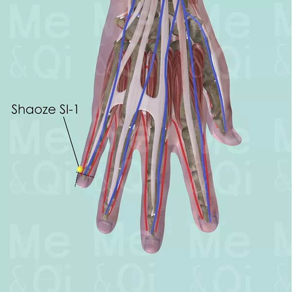 Shaoze SI-1 - Muscles view - Acupuncture point on Small Intestine Channel