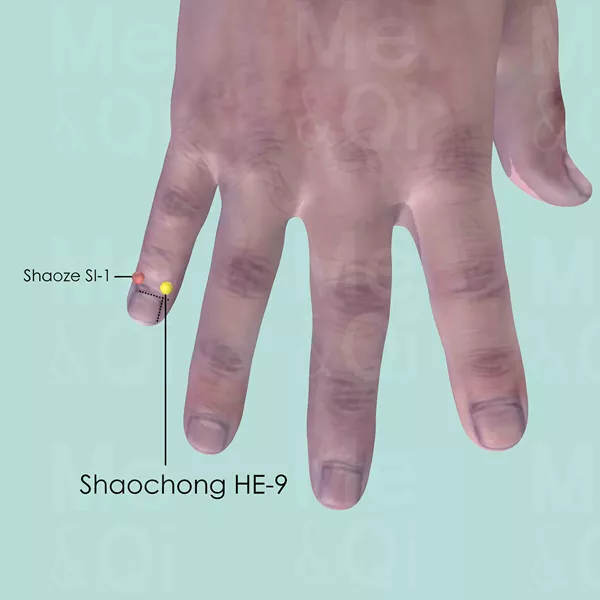 Shaochong HE-9 - Skin view - Acupuncture point on Heart Channel