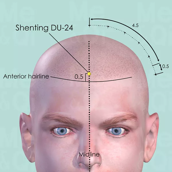 Shenting DU-24 - Skin view - Acupuncture point on Governing Vessel